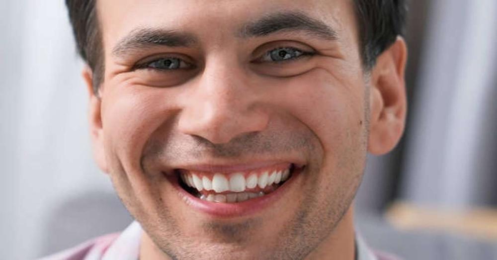 كم سعر ابتسامة هوليود