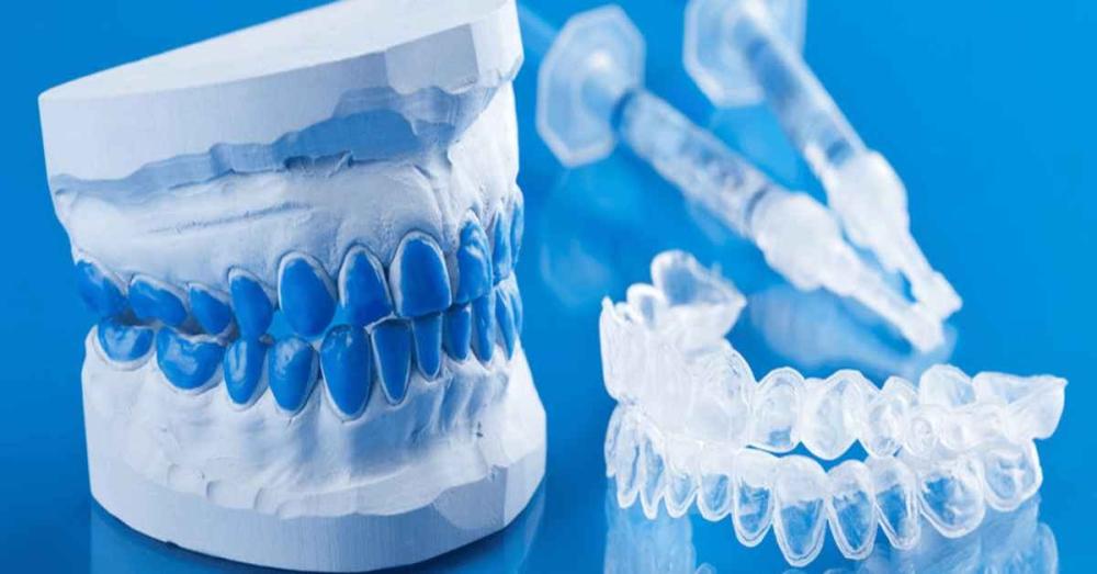 أسعار قوالب تبييض الأسنان