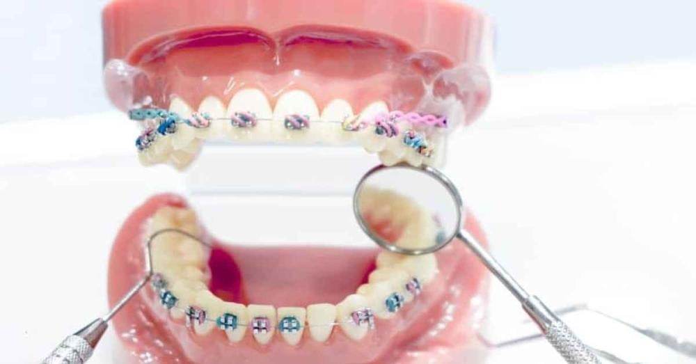 تقويم الاطفال