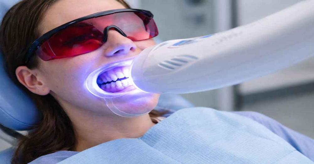 سعر جلسة تبييض الأسنان