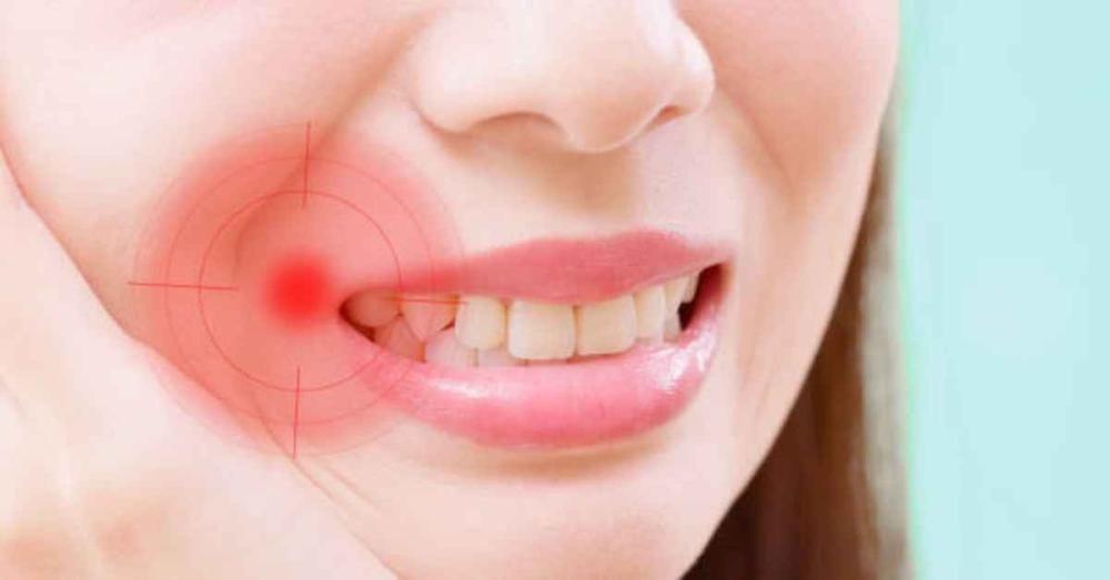 علاج تورم اللثة