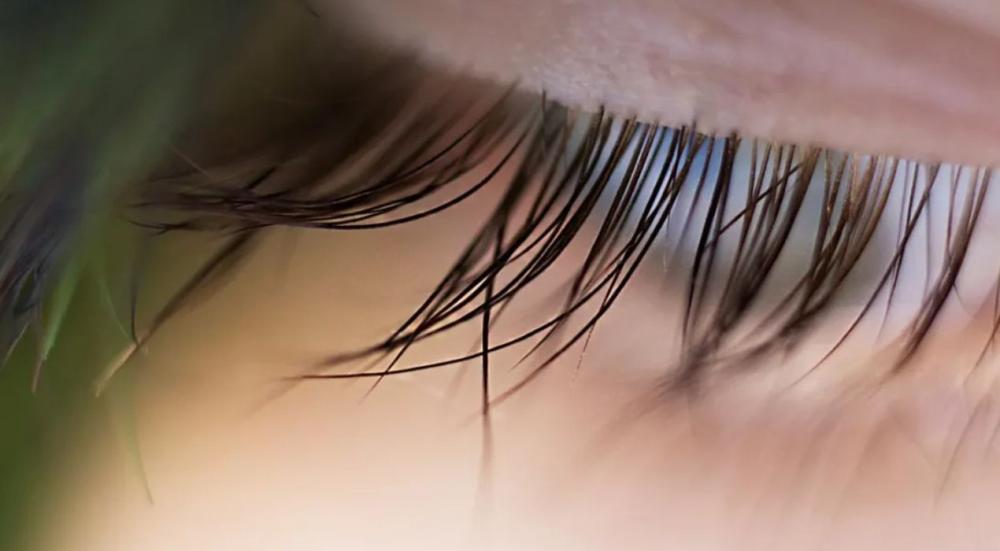 W-eyelashes