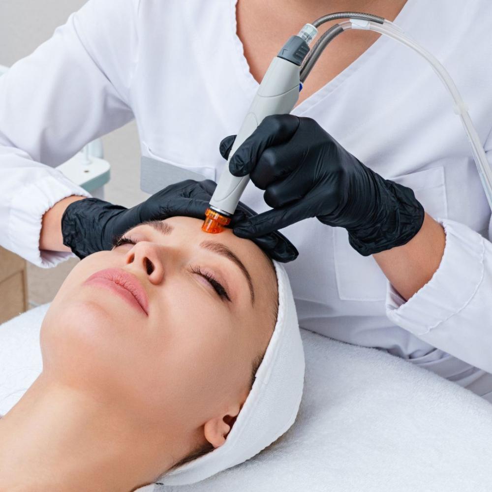 ليزر سبكترا للوجه
