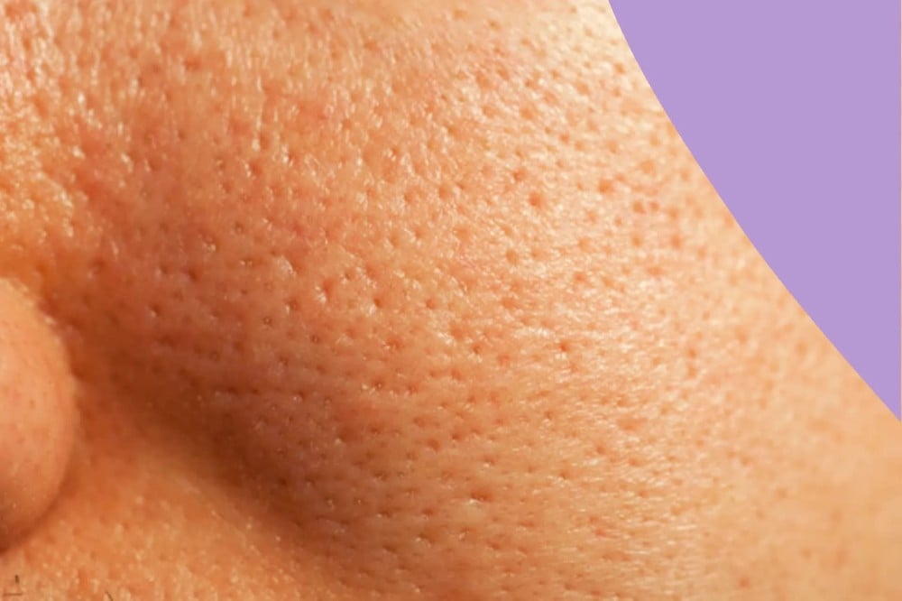 كيف اسكر مسامات الوجه دليلك لتقليل وتنقية مسام الوجه