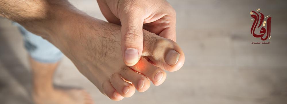 أسباب ألم القدم