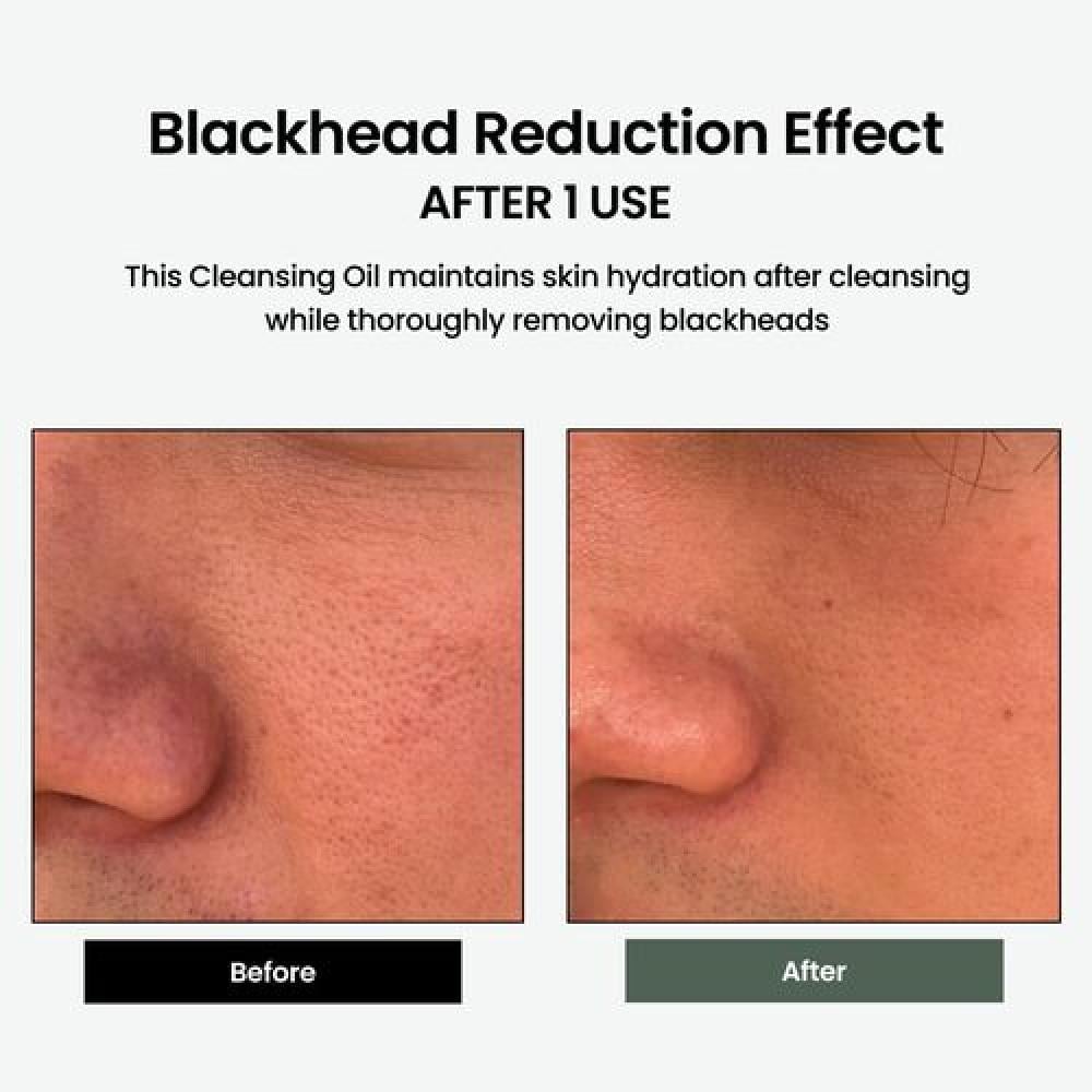 delphyr - Liposome Cleansing Oil  دلفير - زيت تنظيف الليبوزوم