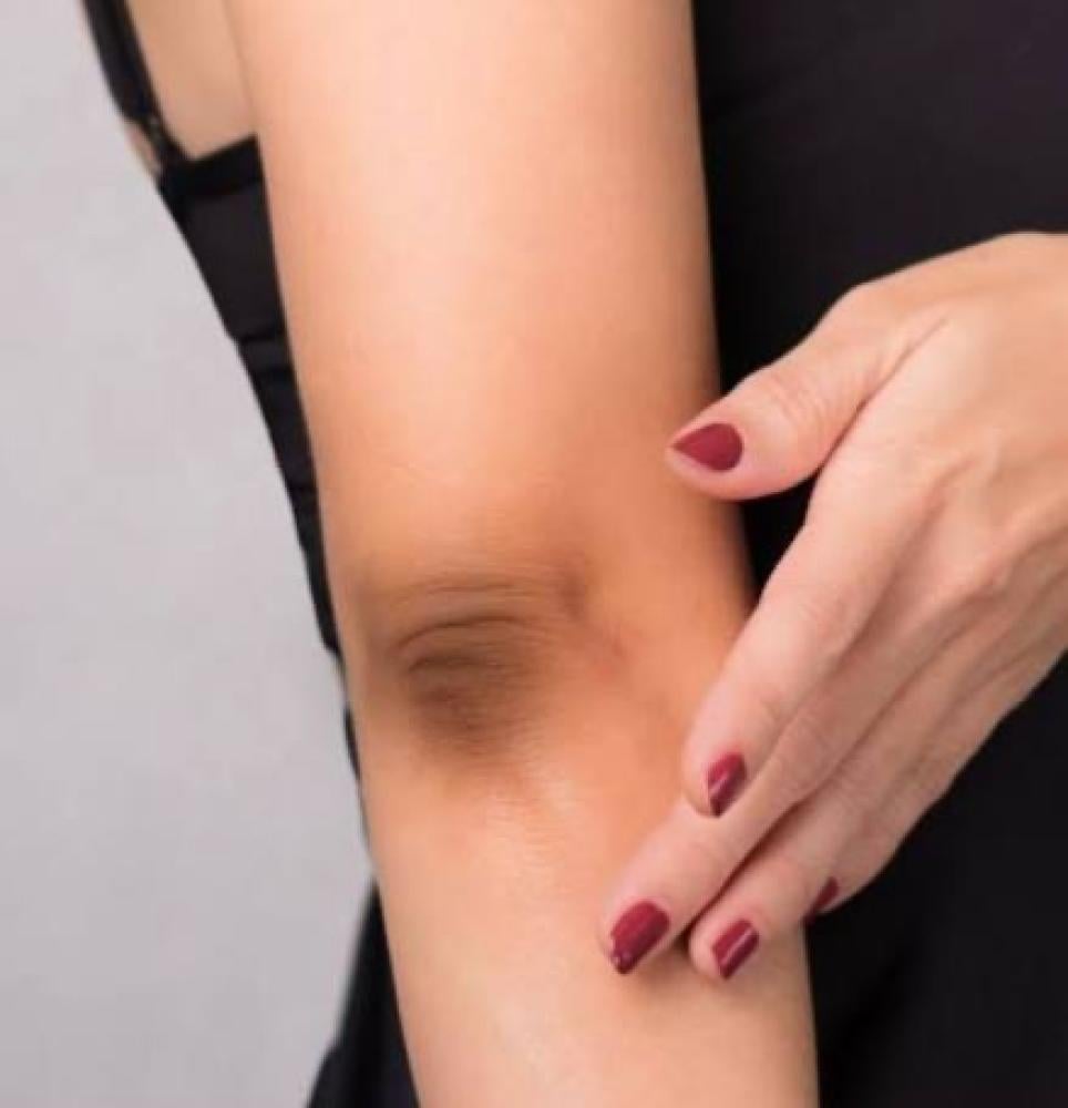 يوريا ٣٠٪ واستخداماته