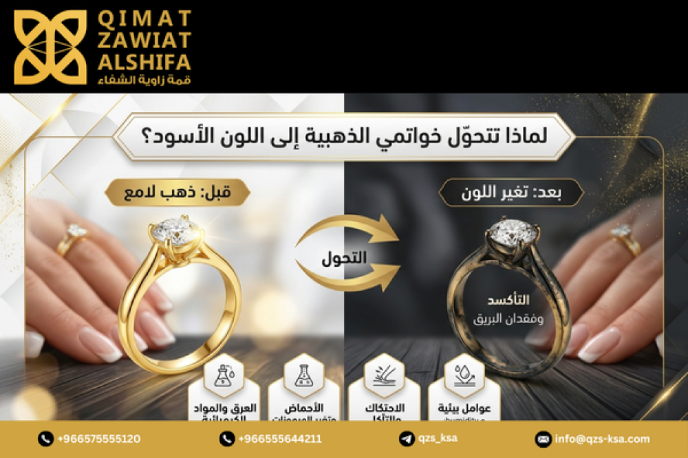 لماذا تتحول خواتمي الذهبية إلى اللون الأسود في إصبعي؟