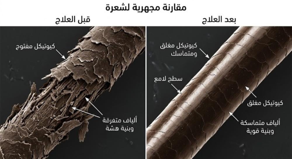 ترميم الشعر قبل وبعد | قصص نجاح حقيقية تثبت قوة العلم في استعادة الجمال