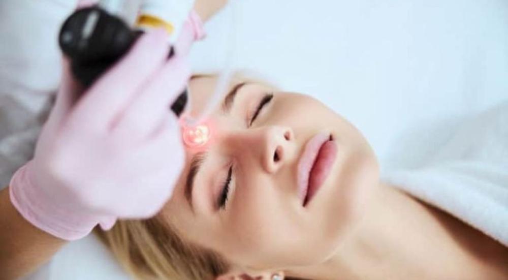 استخدام عدسة الليزر حب الشباب