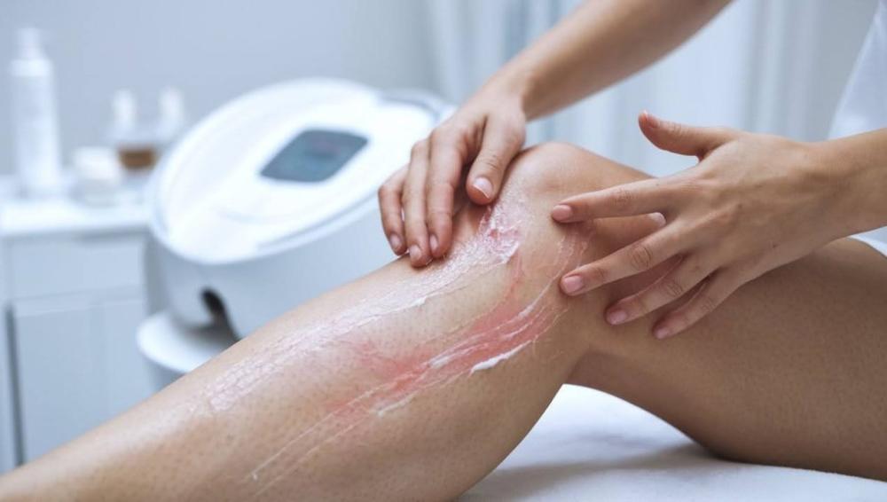 اسباب الحكة بعد الليزر