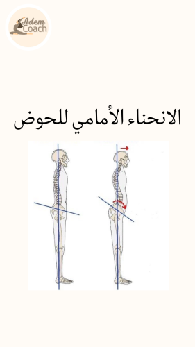 تعديل انحناء الحوض
