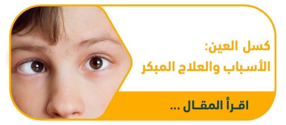 كسل العين (Amblyopia): ليس مجرد ضعف نظر.. اكتشف الأسباب والعلاج المبكر