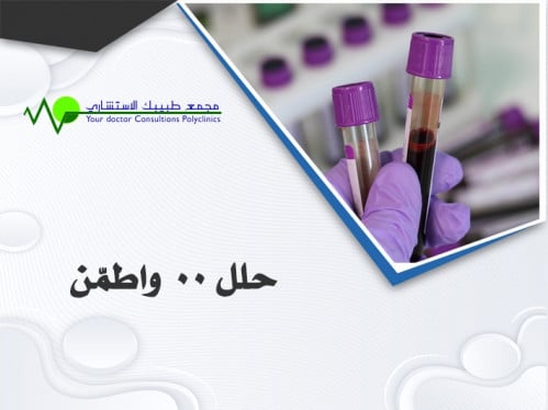 تحليل بول (.Urine Analysis)