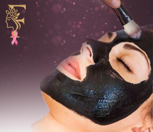 ليزر كربوني