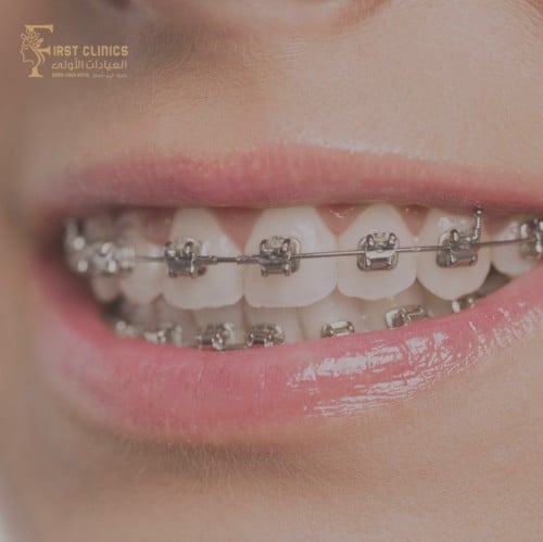 تغيير مطاط لون