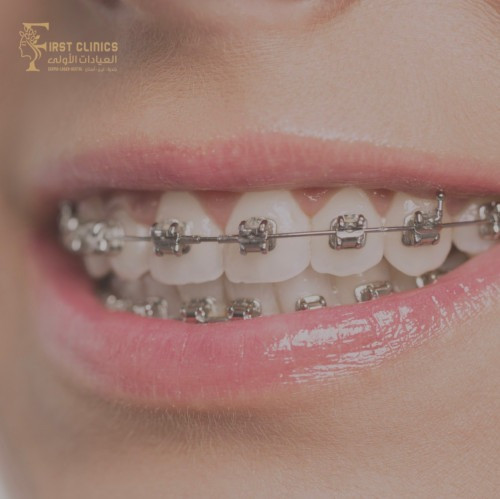 مثبت تقويم ثابت