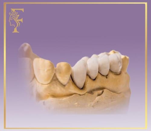 اشعة سيفالومترك