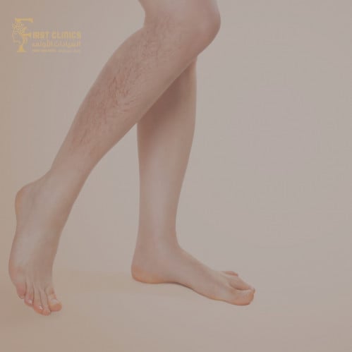 ازالة الأوعية الدموية (الساقين)