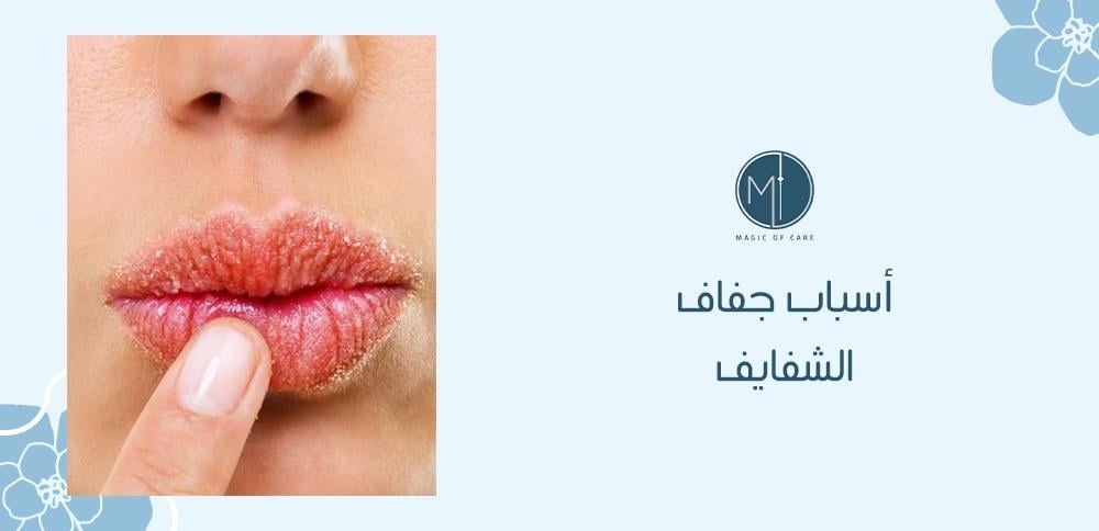 أسباب جفاف الشفايف