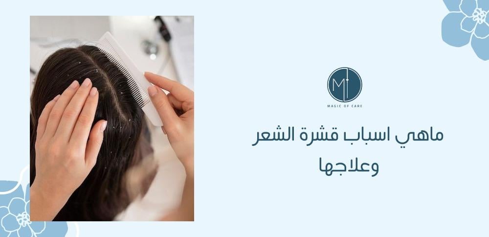 ماهي اسباب قشرة الشعر وعلاجها؟ ماهي اسباب قشرة الشعر وعلاجها؟