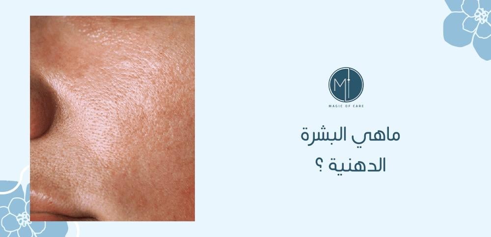 البشرة الدهنية