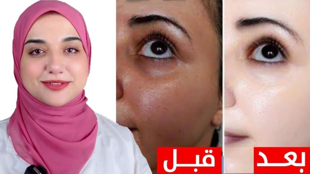 كريم إزالة تصبغات البشرة الدهنية