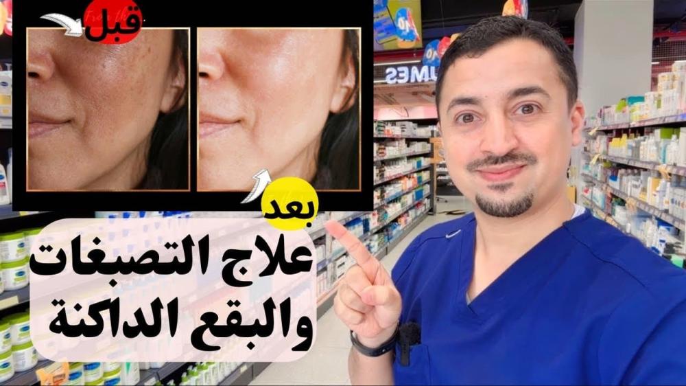 كريم تفتيح التصبغات والبقع الداكنة