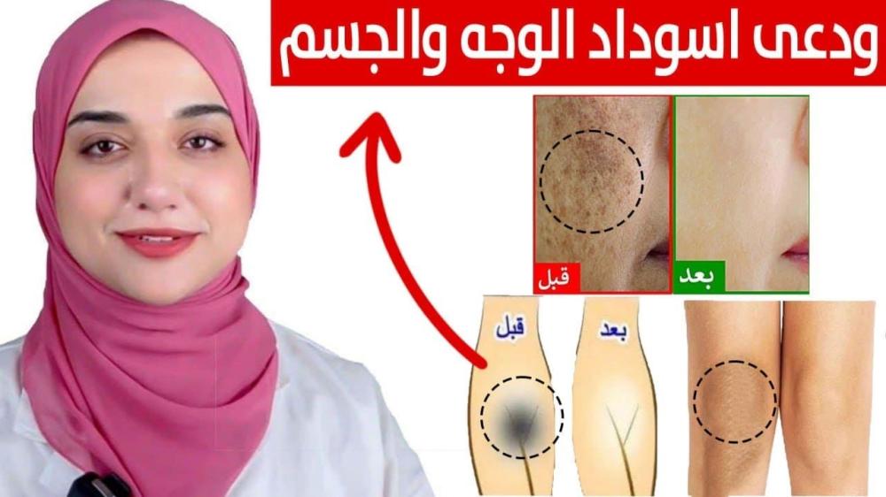 كريم إزالة تصبغات البشرة الحساسة