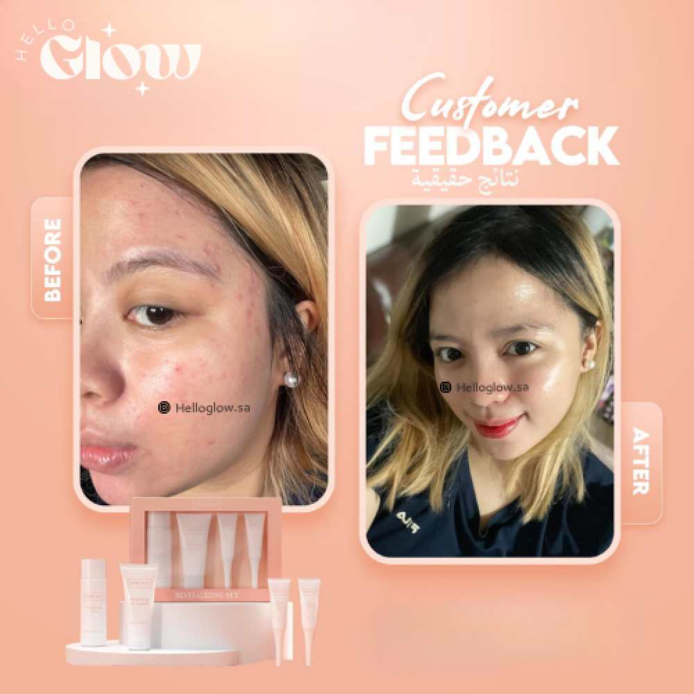 مجموعة ريفيتا قلو للوجة - Esme skin NEW Revitalizing kit