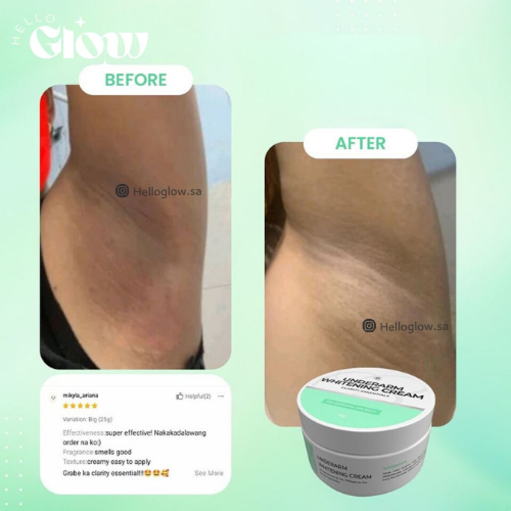 كريم تفتيح الابط Underarm Whitening Cream | Clarity Essentials