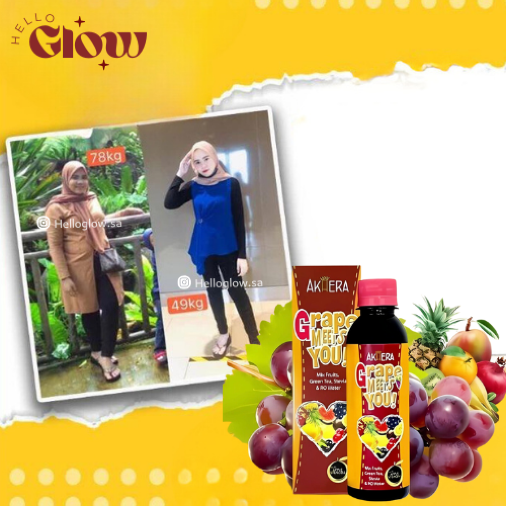 ديتوكس الجسم من ماي تشيري سكين - Akhera My Cherry Skin SLIMMING DETOX SUPPLEMENT