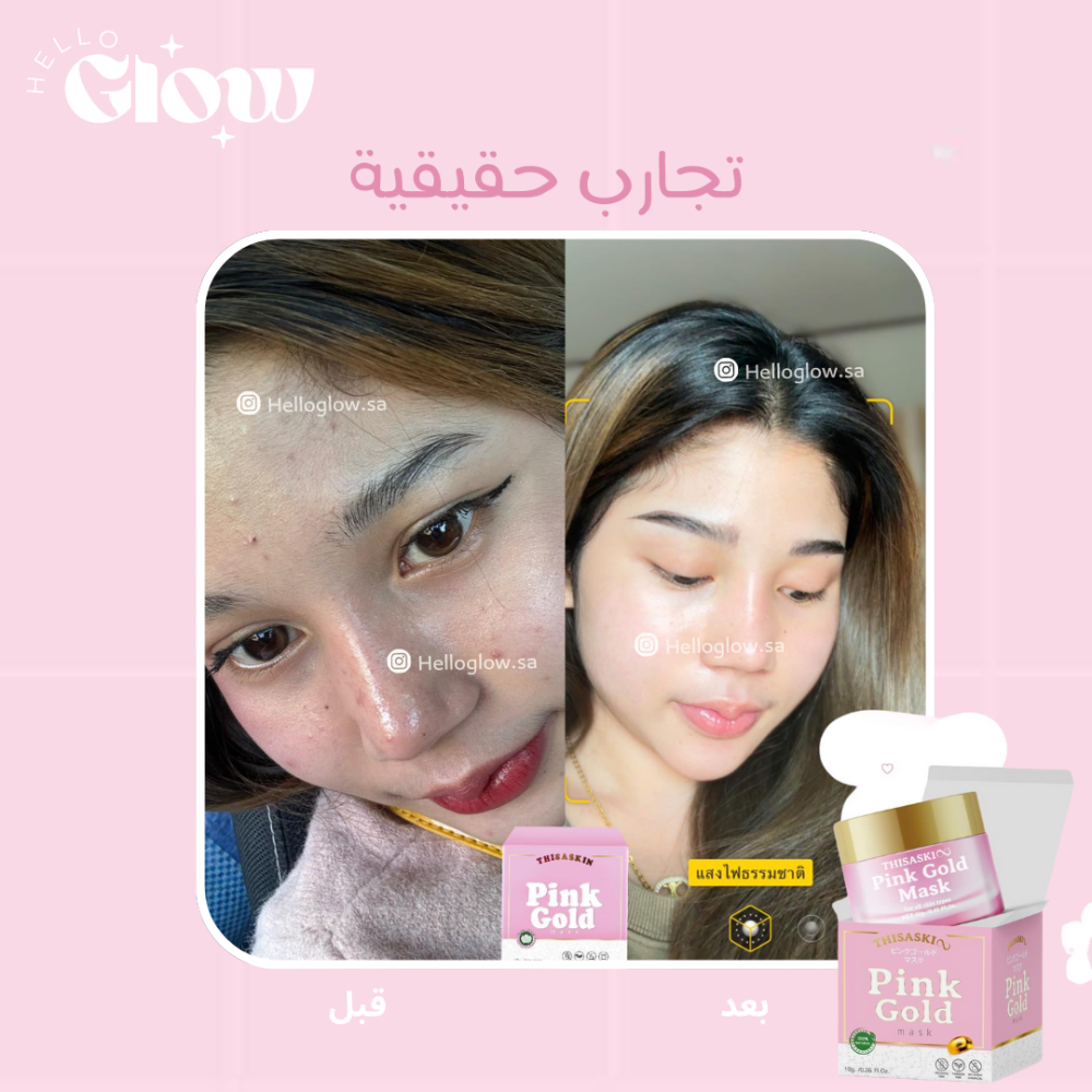 سليبنق ماسك الذهب الوردي - TheSaskui pink gold mask