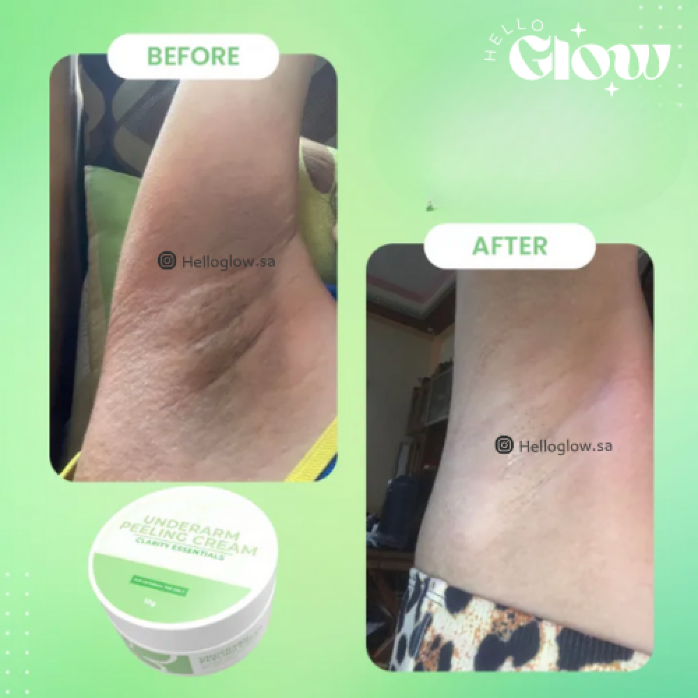 كريم تقشير الابط من كلاريتي Underarm Peeling Cream | Clarity Essentials
