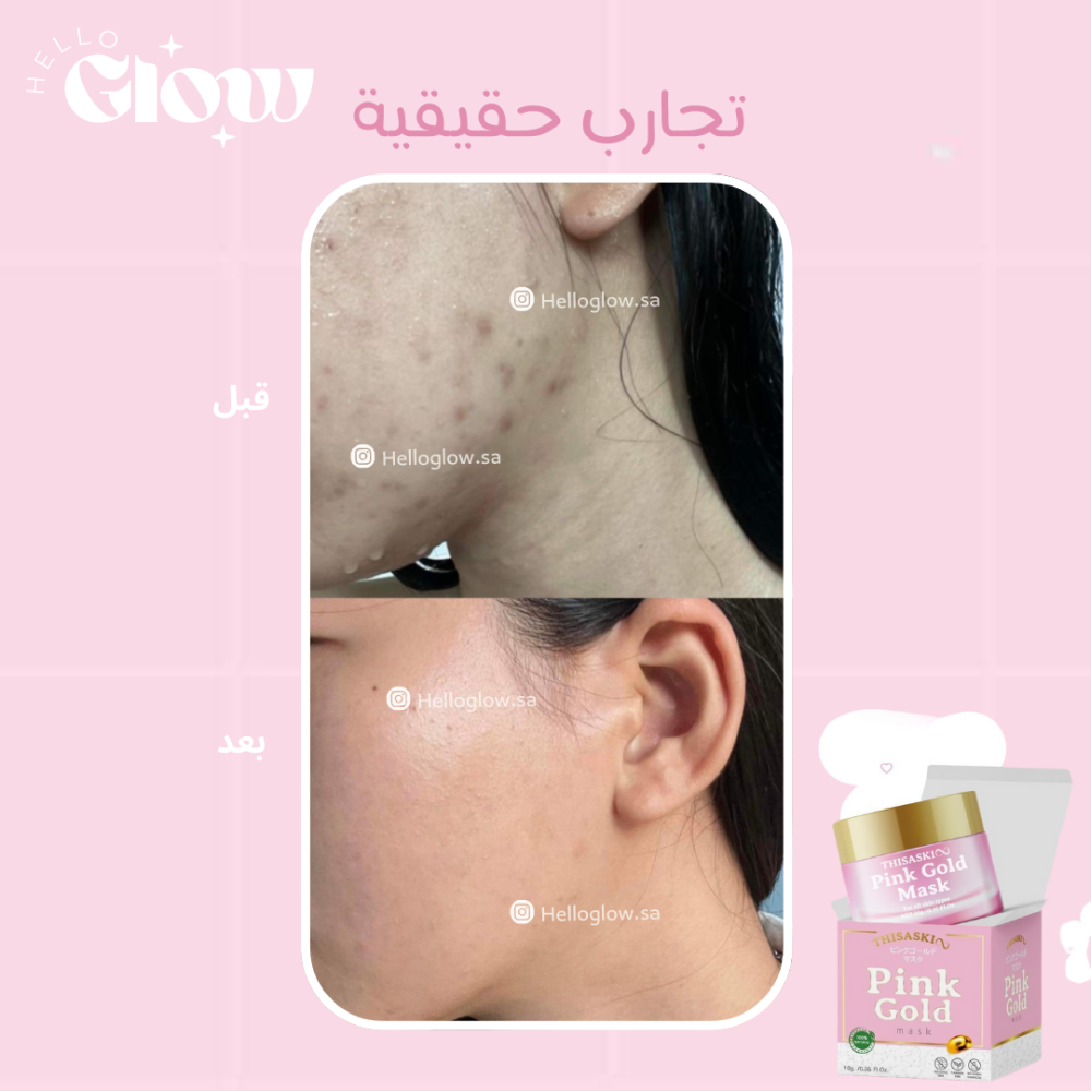 سليبنق ماسك الذهب الوردي - TheSaskui pink gold mask