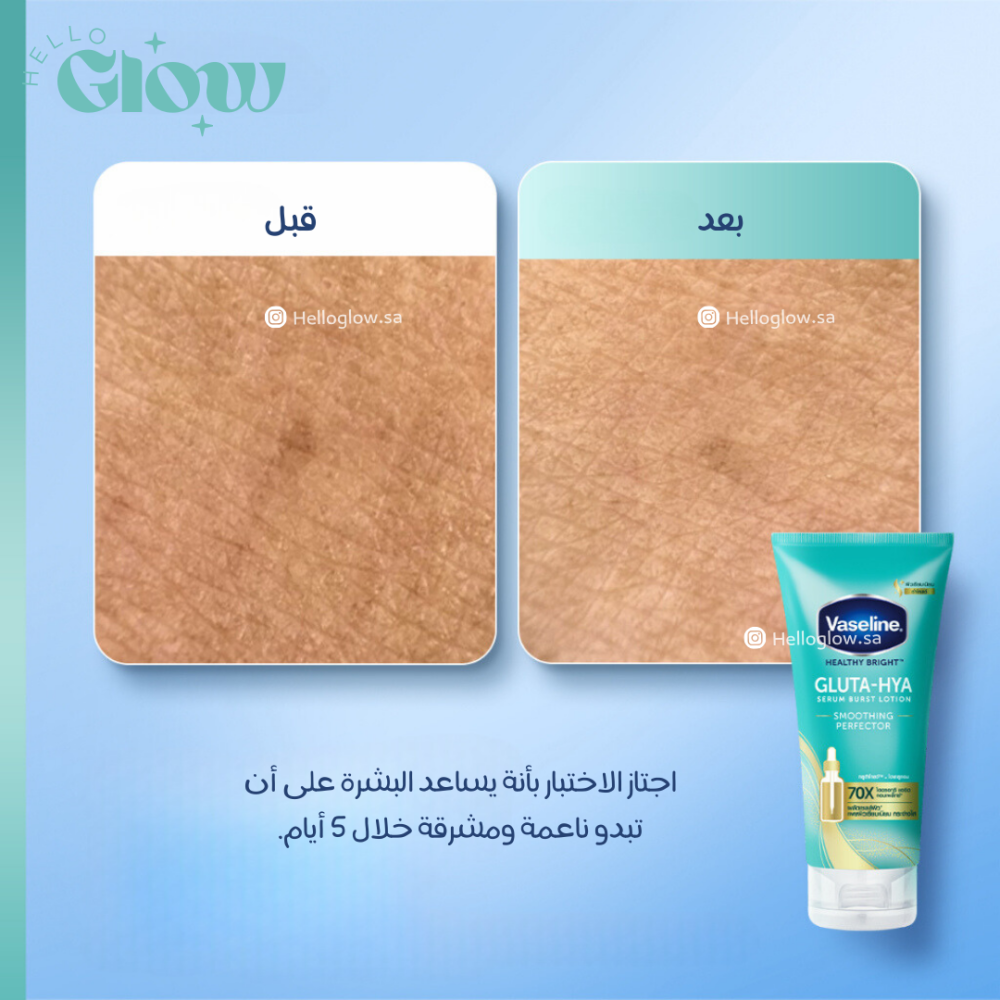 لوشن تقشير وتجديد البشرة فازلين هيلثي برايت جلوتا هيا  - Vaseline Healthy Bright Gluta-Hya Serum Burst Lotion Smoothing Perfector .