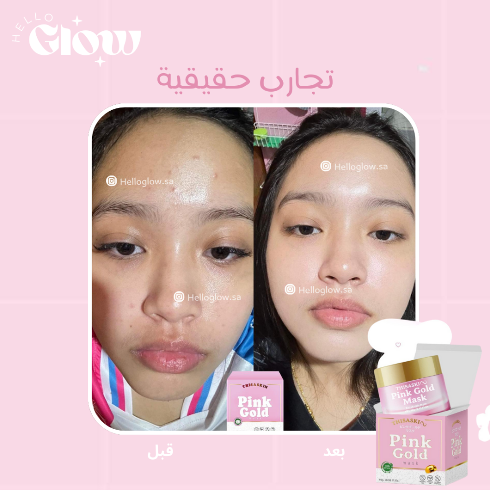 سليبنق ماسك الذهب الوردي - TheSaskui pink gold mask