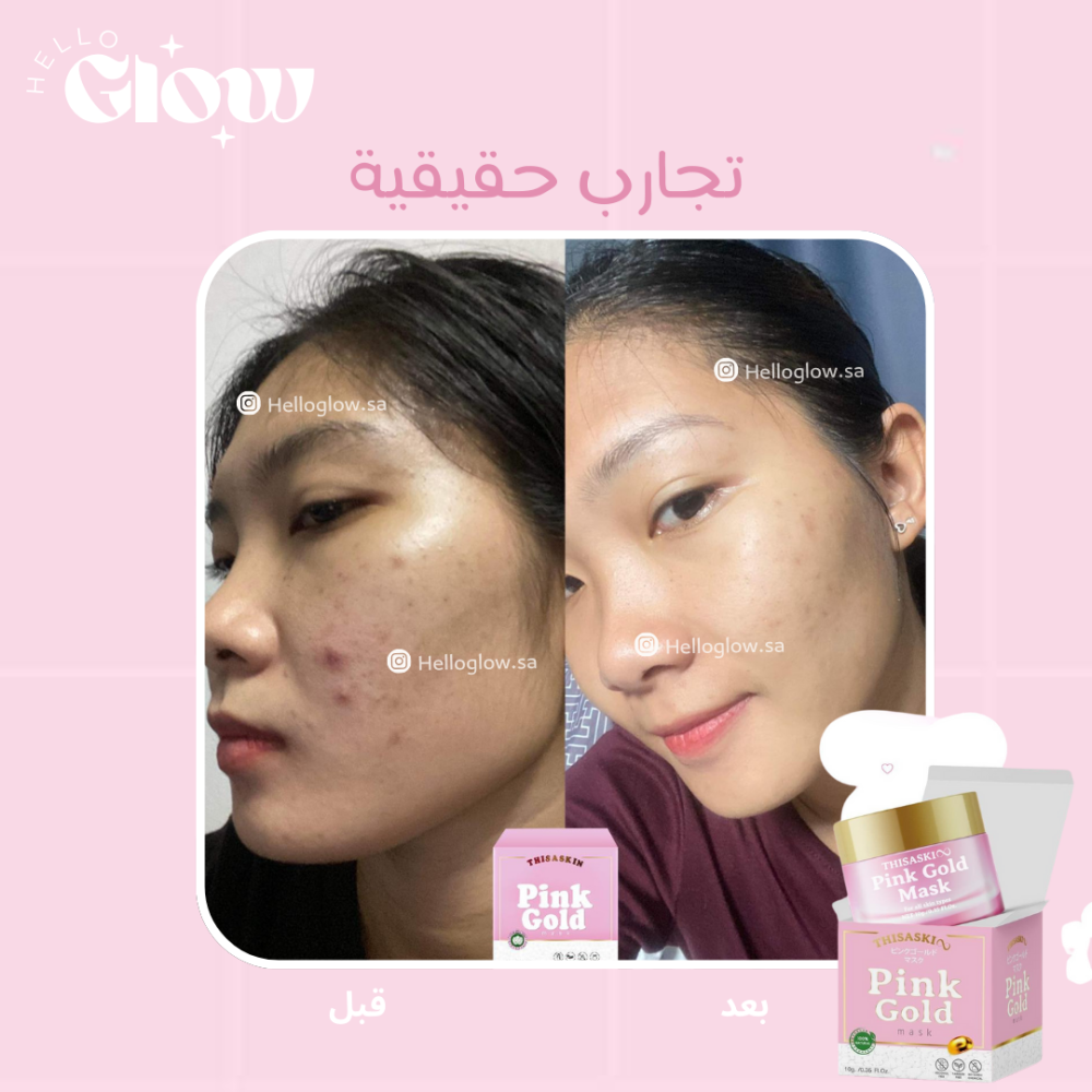 سليبنق ماسك الذهب الوردي - TheSaskui pink gold mask
