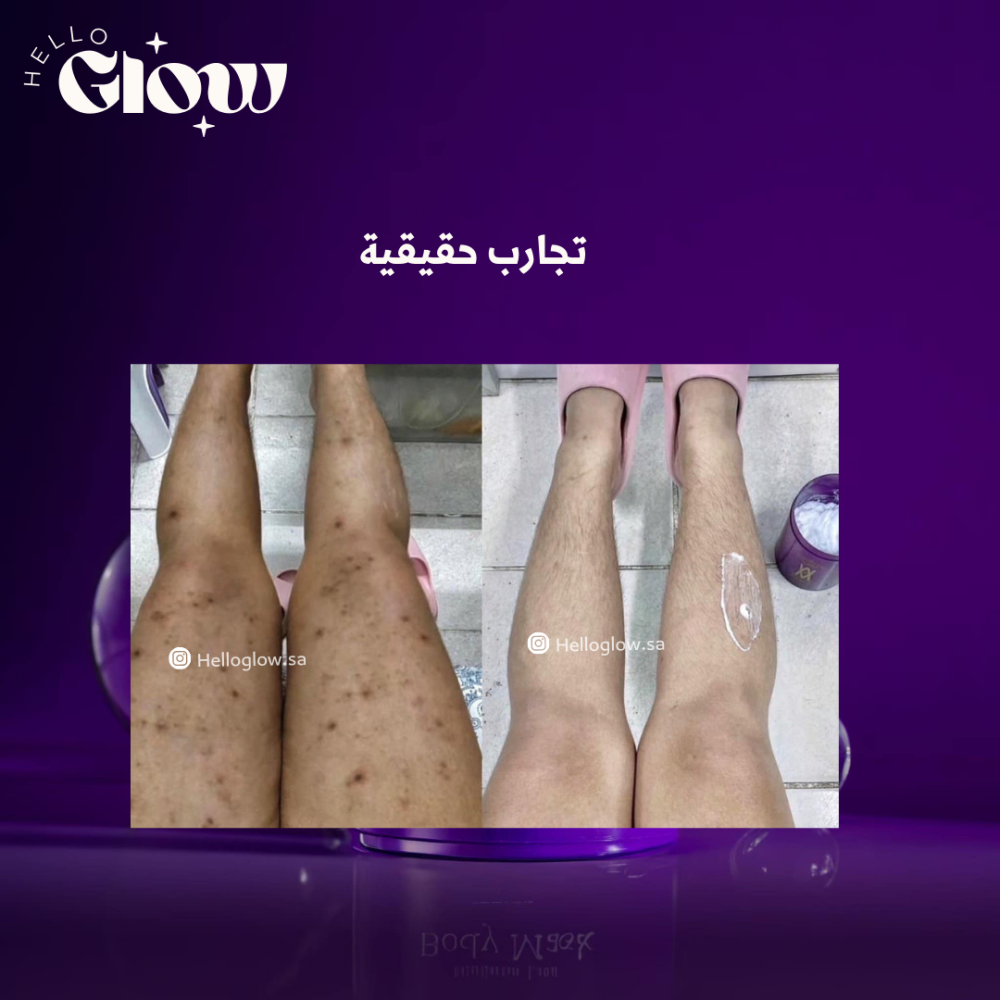 ماسك التفتيح مدام ليزا وايت بلس - Madame Lisa White Plus Mask 2