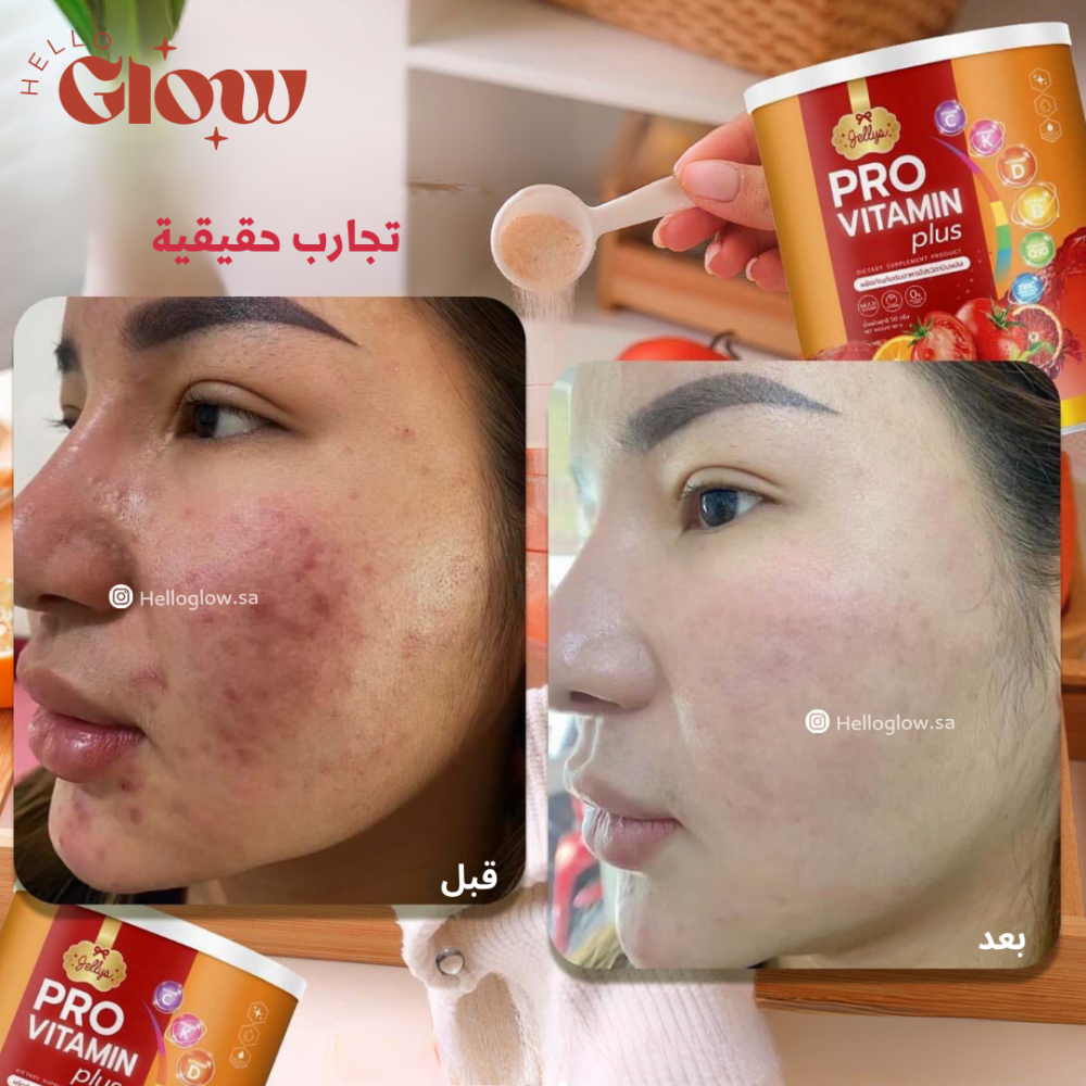 كولاجين الفيتامينات - Jellys Thailand Pro vitamin plus