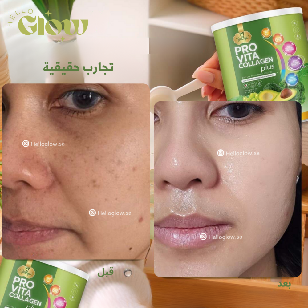 الكولاجين الفواكة الخضراء - Jellys Thailand Pro vita collagen plus