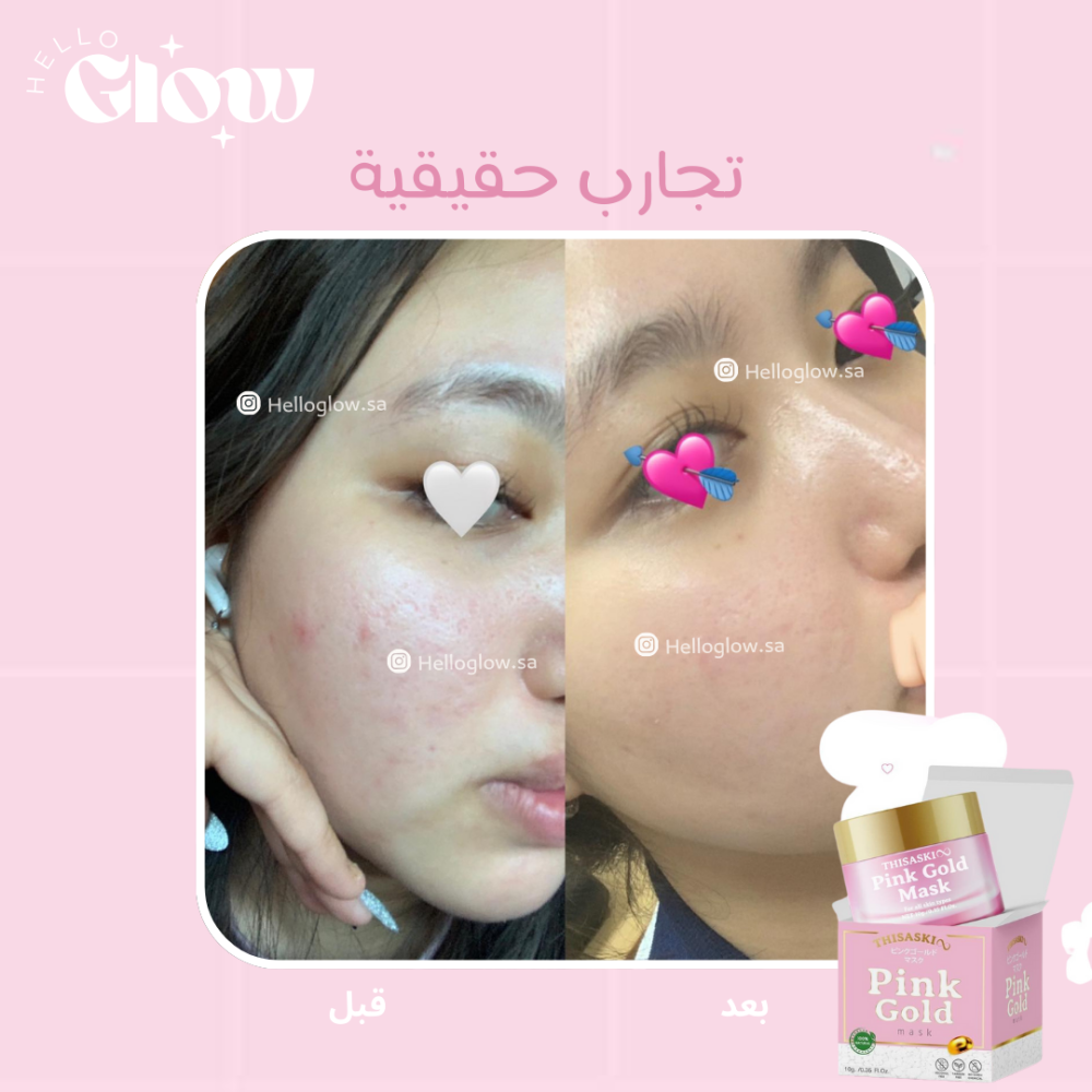 سليبنق ماسك الذهب الوردي - TheSaskui pink gold mask