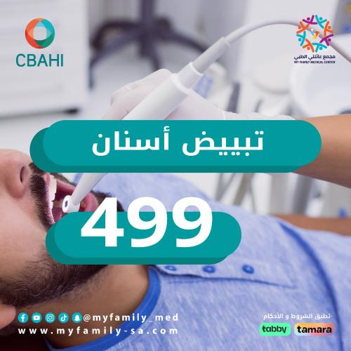 تبييض اسنان