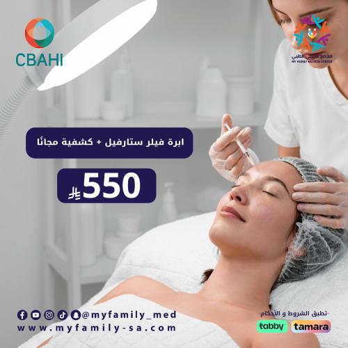 ابرة فيلر ستار فيل