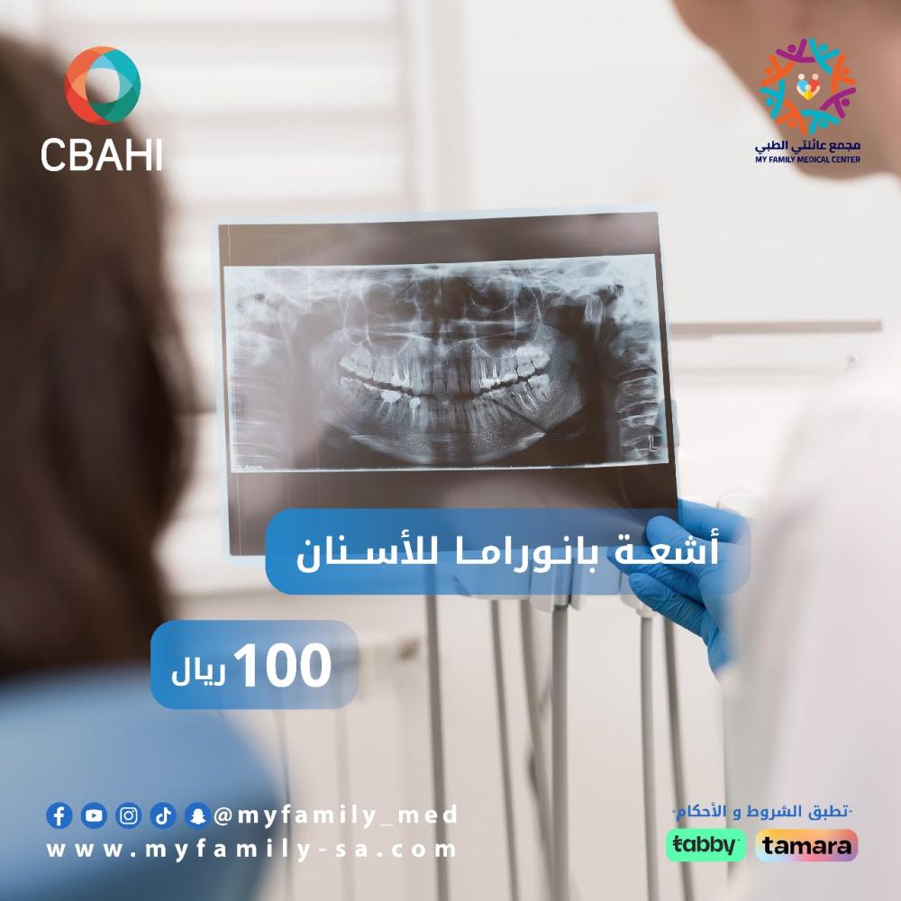 اشعة بانوراما للأسنان