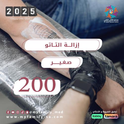 ثلاث جلسات لإزالة التاتو (حجم صغير)