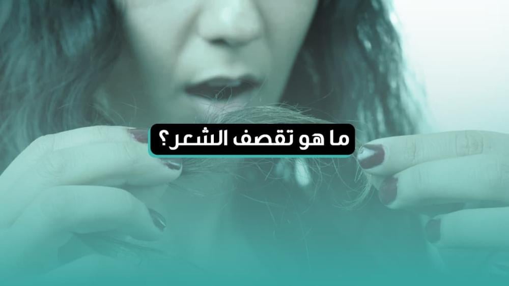 ما هو تقصف الشعر