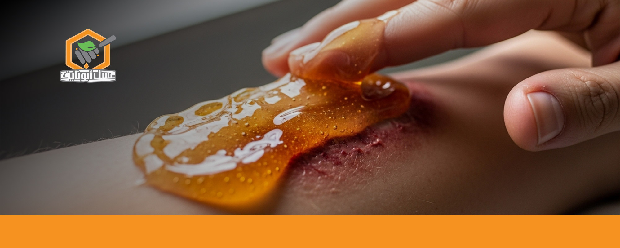 كيفية استعمال العسل للجروح