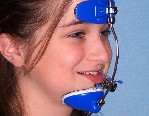 Orthodontic Face Mask
