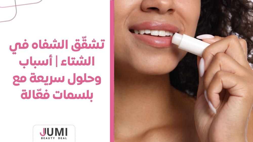 تشقّق الشفاه في الشتاء | أسباب وحلول سريعة مع بلسمات فعّالة